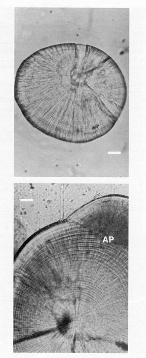 FIG. 7. A comparison of the microstructure of lapilli and sagittae from the same, 20 mm cod. Both otoliths have been polished, and reproduced at the same scale. Bar = 20 µm. The growth sequence in the lapillus (top) has well-defined and spatially-uniform increments, although the latter would become increasingly narrow and difficult to interpret in older juveniles. In contrast, the daily increments in the sagitta (bottom) are narrower than those of the lapillus for the first 5-15 d after hatch (not visible at this magnification), but become increasingly broad with age. Increments towards the edge of the sagitta are more than 3 times as broad as those at equivalent ages in the lapillus; the sagitta also shows evidence of splitting and/or subdaily increments in the outermost 15 d. Daily increments are broader yet, but indistinct, around the newly formed accessory primordium (AP) at upper right.